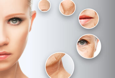 Mesotherapie