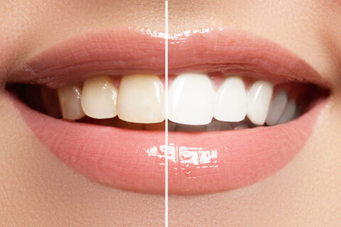 Macro happy woman's smile with healthy white teeth, bright pink lips make-up